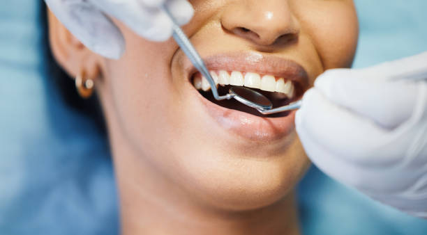 Best Emergency Root Canal Therapy in South Park, WY